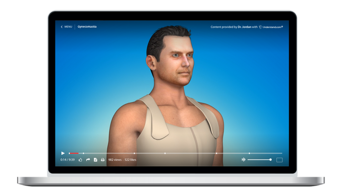 Gynecomastia Surgery Animation